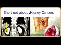 Guide to Kidney Cancer