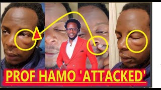 COMEDIAN PROF HAMO BE@TEN LIKE A BURUKENGE OVER PHONE SNATCH!NG,,,NO WAY! GET THE TRUE STORY HERE