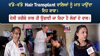 ਵੱਡੇ-ਵੱਡੇ Hair Transplant ਵਾਲਿਆਂ ਨੂੰ ਮਾਤ ਪਾਉਂਦਾ ਇਹ ਬਾਬਾ। ਦੇਸੀ ਤਰੀਕੇ ਨਾਲ ਹੀ ਉਗਾਈ ਜਾ ਰਿਹਾ ਹੈ...