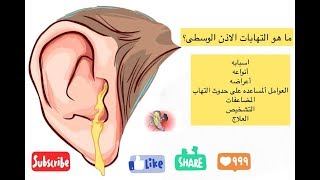 ماهو التهاب الاذن الوسطى: اسبابه و علاجه|Otitis Media