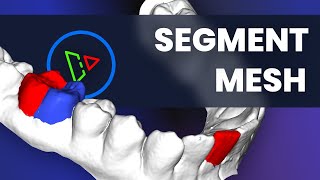 Teeth Segmentation with Segment Mesh Tool
