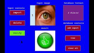 Iris Detection System Using MATLAB GUI