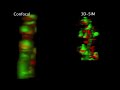 confocal vs 3d structured illumination