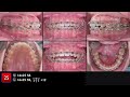 CC367. Cast-Radiograph Evaluation (CRE) Part 3