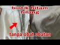 cara menghilangkan noda bintik bintik hitam di laundry sederhana.