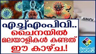 HMPV/china-malayali-doctor  ചൈനയിലെ മലയാളികള്‍ പറയുന്നു...