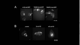 Role of Catenins in Cell Migration