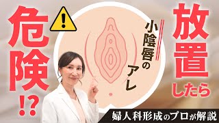 【デリケートゾーン】小陰唇が大きいと、どんなことが起きるの？デメリットと対策を美容外科医が解説します。