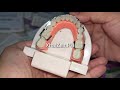 How to wear the fashion ready to wear braces/retainer like braces properly (Upper and Lower)