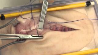 Opening and closing a midline incision (simulated)