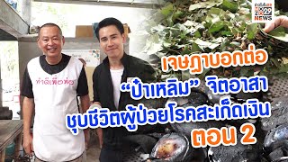 “ป๋าเหลิม”จิตอาสาชุบชีวิตใหม่ผู้ป่วย โรคสะเก็ดเงิน ตอน 2