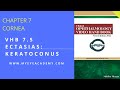 Ectasia Keratoconus | Corneal Ectasia | VHB 7.5