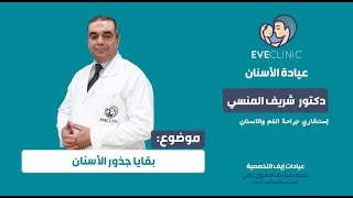 د. شريف المنسي - بقايا جذور الأسنان 🦷🦷 نخلعها ولا نحافظ عليها -ايف كلينك