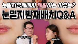 눈밑지방재배치 궁금증 딱 대! | 눈밑재수술, 꺼짐, 다크서클 재발 해결하는✨눈밑지방수술 최강자 등.장✨