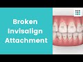 BROKEN INVISALIGN ATTACHMENTS #Shorts