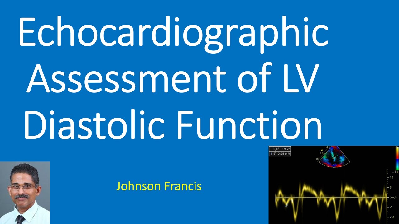 Echocardiographic Assessment Of Lv Diastolic Function Youtube