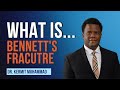 What is a bennett's thumb fracture? Is bennett's thumb fracture a serious injury?