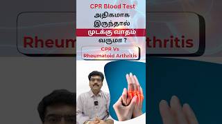 CRP Blood Test அதிகமாக இருந்தால் முடக்கு வாதம் வருமா ?