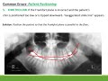 Errors in Panoramic imaging and introduction to Skull radiography and CBCT for dental assistants