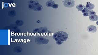 Bronchoalveolar Lavage (BAL) - Obtaining Adequate Sample Yield