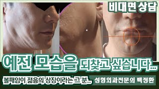 [SUB] 그저 예전 모습을 되찾고 싶습니다. / 얼굴뼈와 연부조직, 비대칭 등을 고려하지 않은 안타까운 수술 [비대면상담 #160] / Just like before...