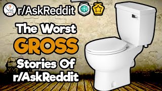 People Reveal The Grossest, Nastiest, Most Disgusting Things (1 Hour Reddit Compilation)