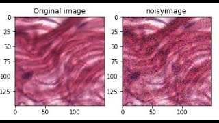 Top Data Augmentation Techniques for Computer Vision