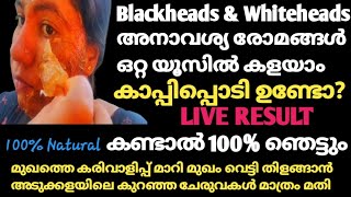 Blackheads \u0026 Whiteheads/ അനാവശ്യ രോമം /കരുവാളിപ്പ്  മാറി മുഖം വെട്ടി തിളങ്ങാൻ ഇങ്ങനെ  ചെയ്തു നോക്കൂ.