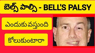 బెల్స్ పాల్సి | BELL'S PALSY |ఎందుకు వస్తోంది | వారు కోలుకుంటారా ??