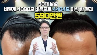 모발이식 비용 50대 깊게 패인 M자탈모 비절개 4464모이식 590만원 #모발이식#비절개모발이식#50대모발이식