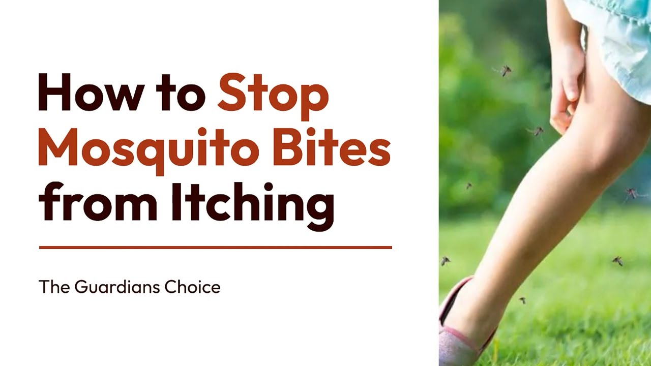 4 Ways To Stop Mosquito Bites From Itching | How To Stop Mosquito Bites ...