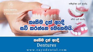 කෘතීම දත් ඇඳි (Dentures)