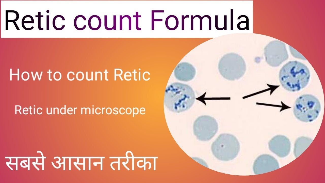 Reticulocyte Count Calculation