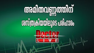 അമിതവണ്ണം | ഡോക്ടര്‍ ലൈവ് 13 ജൂണ്‍ 2016