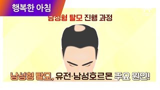 남성형 탈모의 원인 [유전과 남성호르몬] 충격적인 탈모 진행 과정 공개! | 행복한 아침 158회