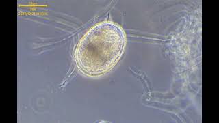 4K活性汚泥の微生物　ワムシ(Rotifer)の卵　孵化直前