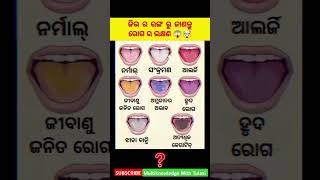 ଜିଭ ର ରଙ୍ଗ ରୁ ଜାଣନ୍ତୁ ରୋଗ ର ଲକ୍ଷଣ ? #viral #shortvideos #foryou #viralvideos #motivation