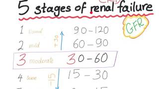 Mnemonic: the 5 Stages of chronic kidney disease, based on GFR