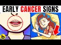 11 Early Cancer Warning Signs That You Shouldn't Ignore