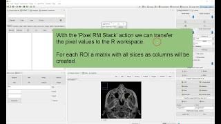 Transfer Stack ROI's