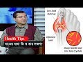 বাতের ব্যথা কি ও তার লক্ষণ? | Health Tips | Gout Pain | Somoy TV