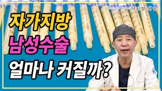 남성수술 자가지방은 얼만큼 확대되는지 알려드림