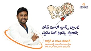 బోన్ మారో ట్రాన్స్ ప్లాంట్ (స్టెమ్ సెల్ ట్రాన్స్ ప్లాంట్)