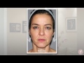 y lift ® 2015 carla ft. on e news instant non surgical facelift