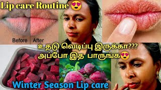 Winter season Lip care routine in tamil/How to get soft and pink lips/Lip care 🤩/ Azhakin Mugavari