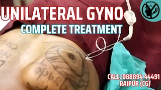 Unilateral Gynecomastia | Unilateral Gyno Complete Treatment | Dr. Yatindra Dewangan | Raipur CG