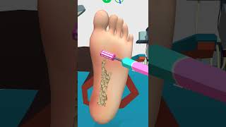 ASMR 시원함 주의! 리얼한 내성 발톱 케어 애니메이션 | Ingrown Toenail removal treatment animation #shortvideo #shorts