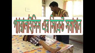 প্যারালাইসিস ।স্ট্রোক । STROKE । PARALYSIS এর আধুনিক চিকিৎসা  জানতে  এই ভিডিওটি।