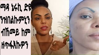 ንዝሓተትኩምኒ ማዳ ብኸመይ ኣጥፊኣዮ ክምልሰልኩም😍❤❤