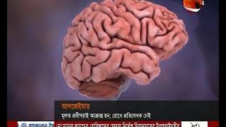 আলঝেইমার: মানুষের স্মৃতিশক্তি নষ্ট করে- CHANNEL 24 YOUTUBE